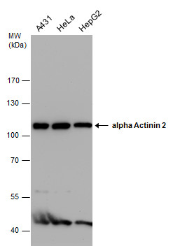 alpha Actinin 2 antibody [GT1253]