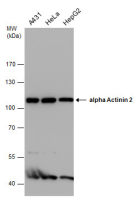 alpha Actinin 2 antibody [GT1253]
