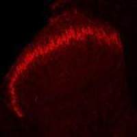 Prostatic Acid Phosphatase antibody