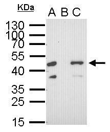 RFP antibody [GT1610]产品图