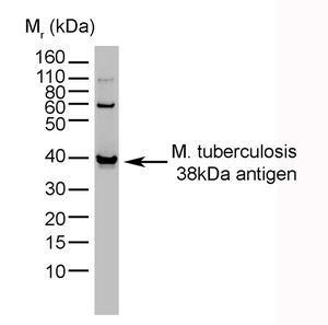 Mycobacterium tuberculosis 38 kDa antibody [BGN/1209/3875]