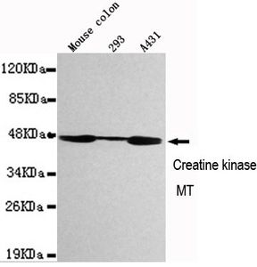 Creatine kinase MT antibody [1A6-C7-G10]