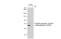 ZAP70 (phospho Tyr319) / Syk (phospho Tyr352) antibody [GT1686]