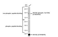 ROCK2 (phospho Ser1366) antibody [HL1071]