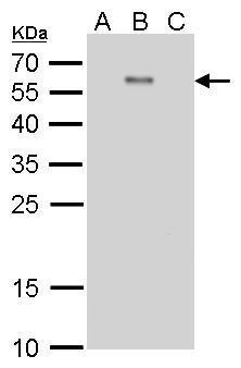 Dengue virus Envelope protein antibody [GT214]