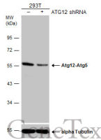 ATG12 antibody [GT9411]