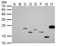 6X His tag antibody [GT161]