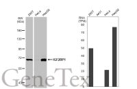 IGF2BP1 antibody