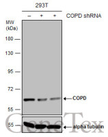 COPD antibody [GT1318]