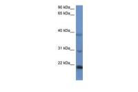 IMMP2L antibody, N-term