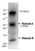 E. coli LT toxin antibody