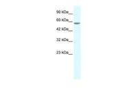 GTF2E1 antibody, C-term