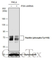 Paxillin (phospho Tyr118) antibody [GT162]