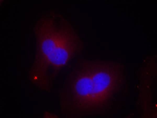 FAK (phospho Tyr925) antibody