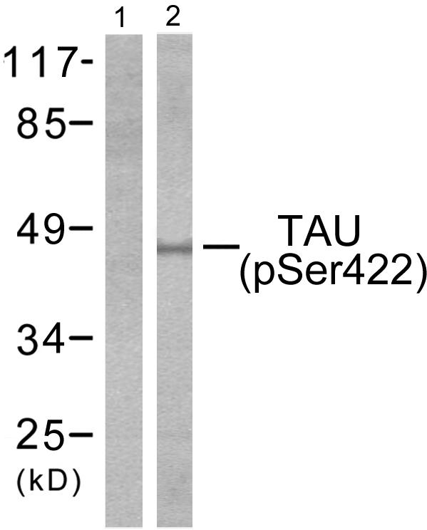 Tau (phospho Ser422) antibody