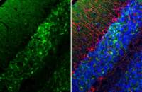 alpha Synuclein antibody [HL1243]