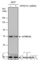 ATP6V1A antibody [GT1561]