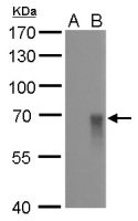 Influenza A virus H1N1 HA (Hemagglutinin) antibody [GT521]