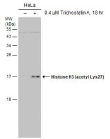 Histone H3K27ac (Acetyl Lys27) antibody [GT261]