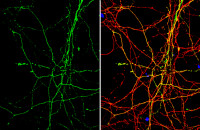 beta Alanine antibody