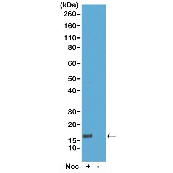 Histone H3T6ph (phospho Thr6) antibody [RM160]