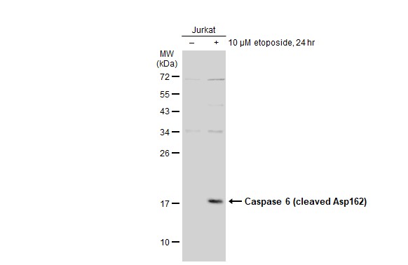 Caspase 6 (cleaved Asp162) antibody
