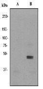 JNK (phospho Tyr185) antibody [EP1597Y]