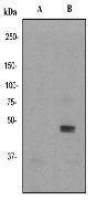 JNK (phospho Tyr185) antibody [EP1597Y]