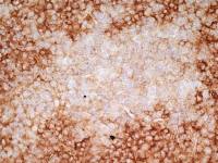 CD36 antibody [SMØ] (Azide free)