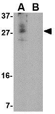 CDNF antibody