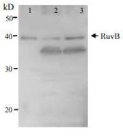 RuvB antibody