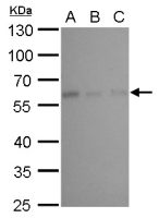 NDP52 antibody [GT17410]