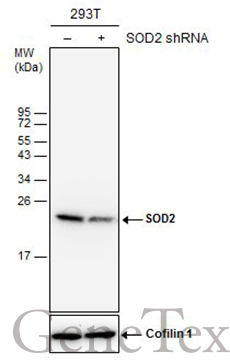 SOD2 antibody [GT17112]