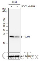 SOD2 antibody [GT17112]