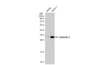 Galectin 3 antibody [GT759]