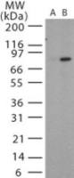 Bacillus anthracis protective antigen antibody