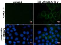 Carbonic Anhydrase IX antibody [GT14212]