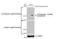 ATR (phospho Thr1989) antibody [HL132]