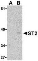 ST2 antibody, N-term