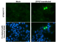 ZFP57 antibody [GT1115]