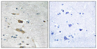 ABHD4 antibody