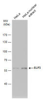 ELP3 antibody [GT11811]