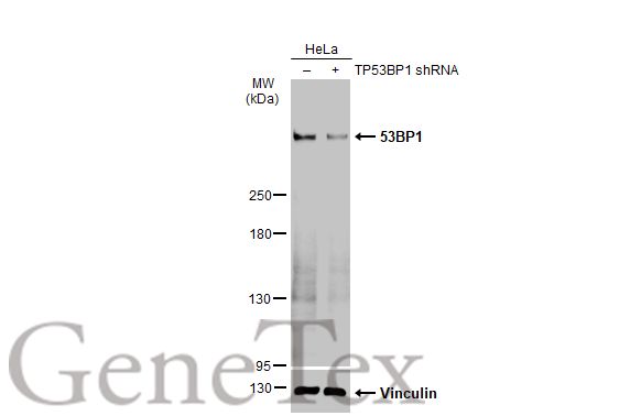 53BP1 antibody [HL275]