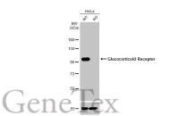 Glucocorticoid Receptor antibody [HL1151]