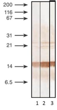 Procalcitonin antibody [44D9]