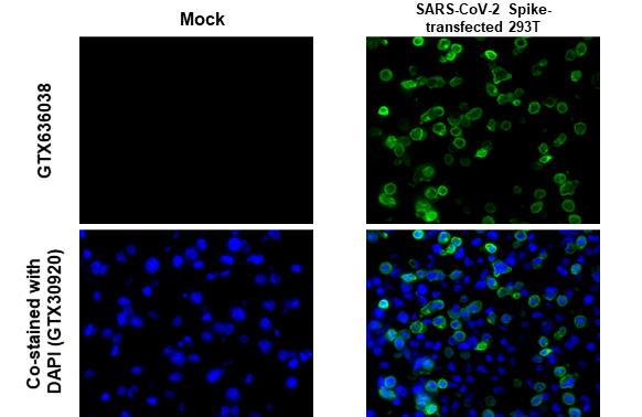 SARS-CoV-2 (COVID-19) Spike S2 antibody [GT8110]