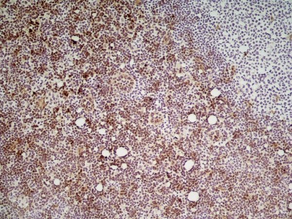 Ly6c antibody [ER-MP20]