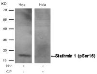 Stathmin 1 (phospho Ser16) antibody