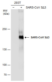 SARS-CoV Spike (SΔ3) antibody [7G12]