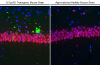 beta Amyloid (1-42) antibody – Conformation Specific antibody [GT622]